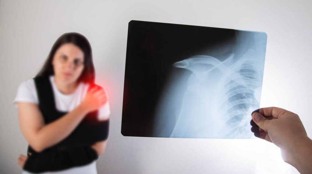 When to Get Help for a Shoulder Injury